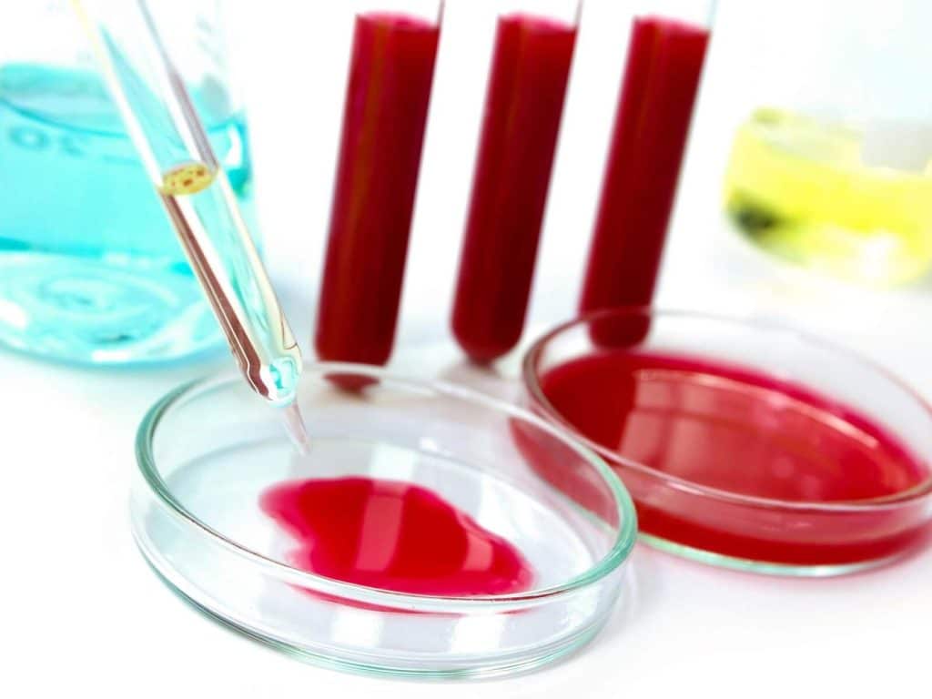 Исследование крови на биохимию